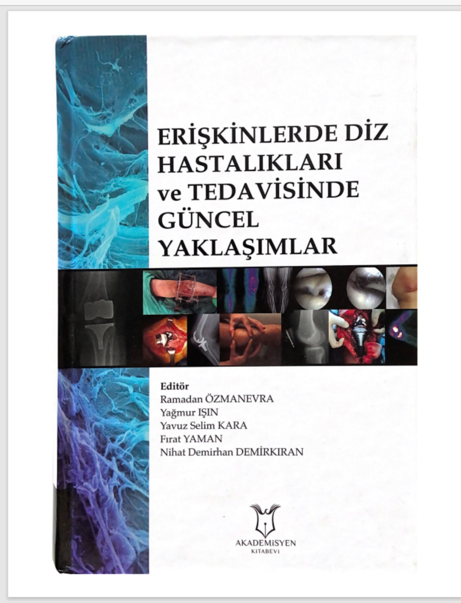 DİZ CERRAHİ YAKLAŞIM TEKNİKLERİ
