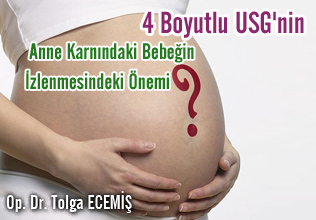 4 boyutlu usg'nin anne karnındaki bebeğin izlenmesindeki önemi