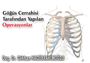 Göğüs Cerrahisi Tarafından Yapılan Operasyonlar