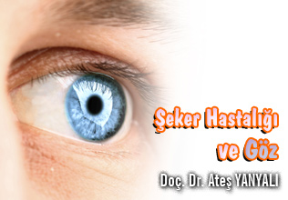 Diyabet (Şeker Hastalığı) ve Göz makalesi
