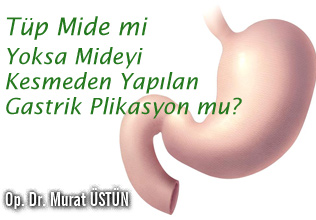 Tüp mide mi yoksa mideyi kesmeden yapılan gastrik plikasyon mu?