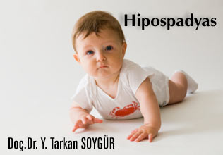 Hipospadias ve Tedavisi