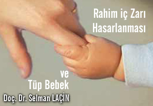 Rahim iç zarı hasarlanması ve tüp bebek