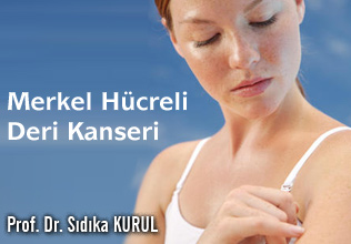Merkel hücreli deri kanseri ( nöroendokrin deri kanseri) : nadir rastlanan bir  deri kanseri türü.