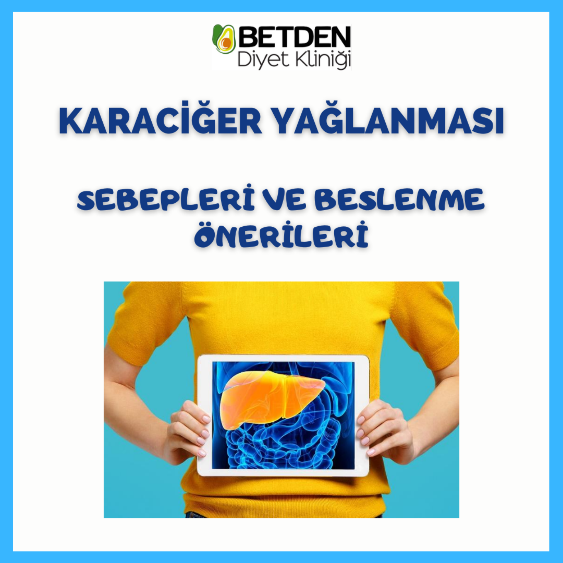 Tek Suçlu Alkol Mu? Karaciğer Yağlanması Sebepleri ve Beslenme Tedavisi makalesi