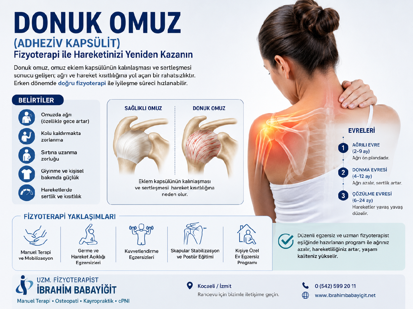 Donuk Omuz Tedavisi Kocaeli | Uzm. Fzt. İbrahim Babayiğit