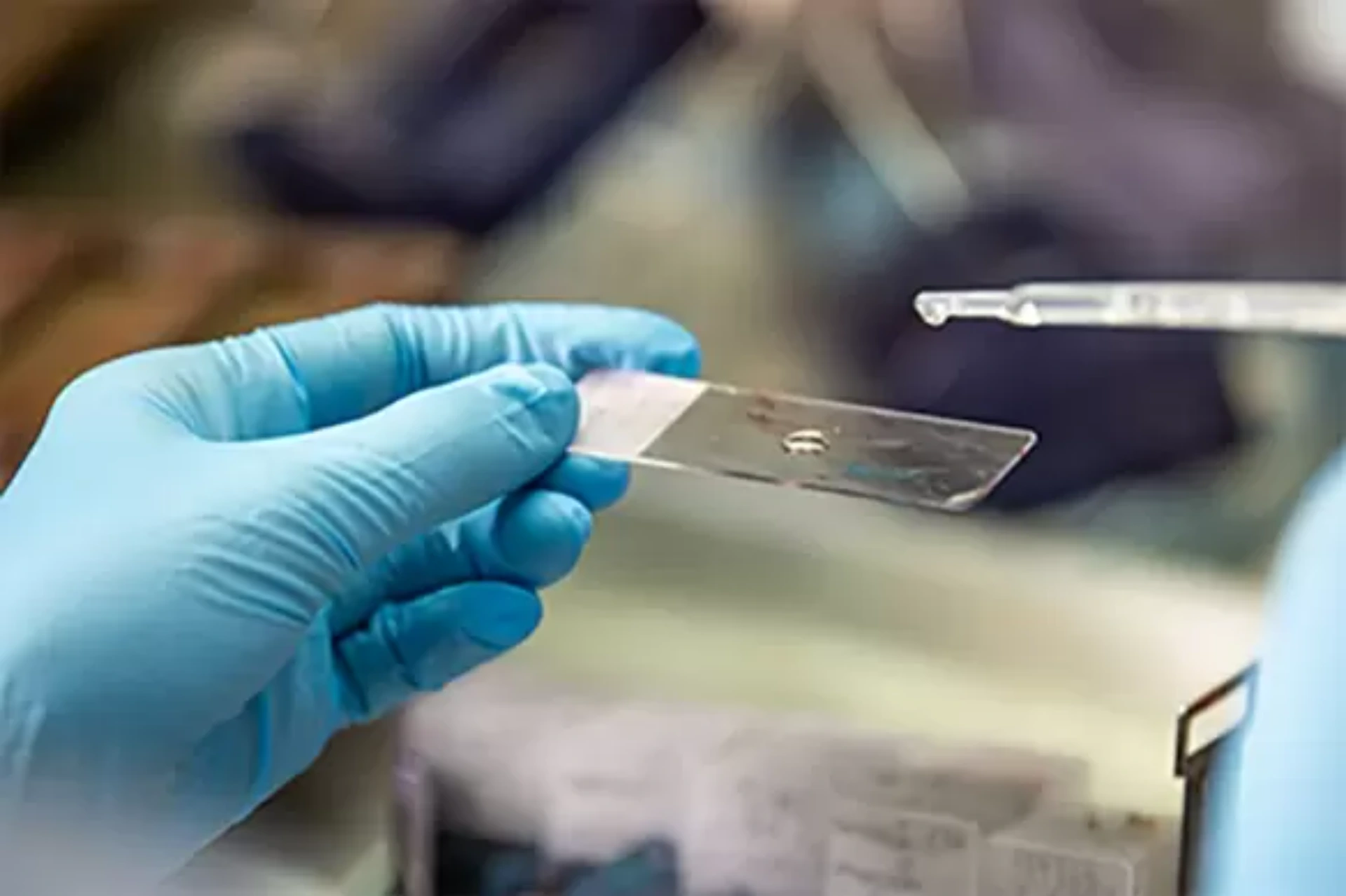 SMEAR TESTİNDE ASCUS  ÇIKMASI