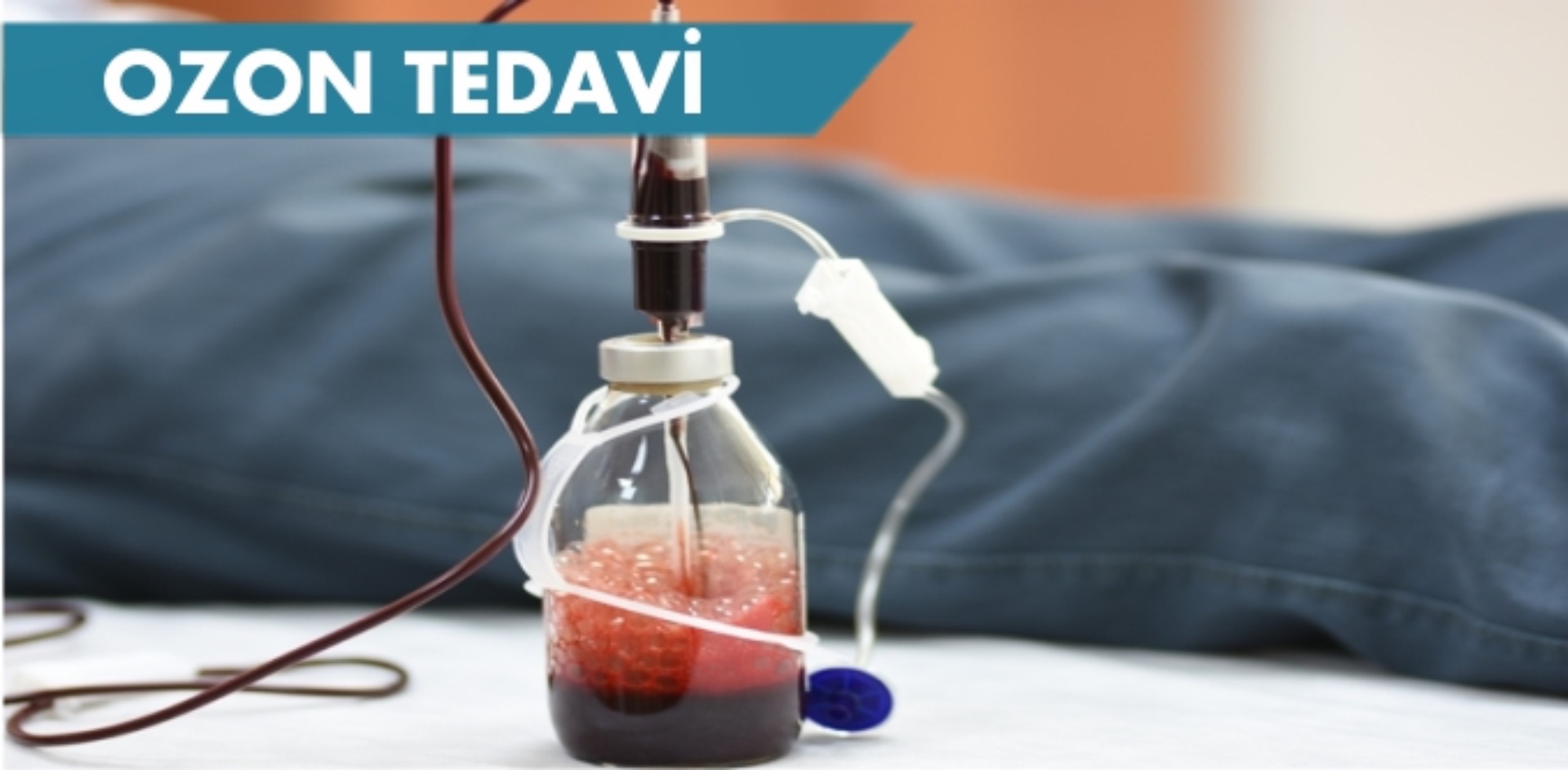 OZON TEDAVİSİ VE ROMATOİD ARTRİT