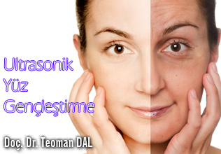 Ultrasonik yüz gençleştirme ( germe ) nedir?