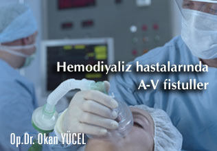 Hemodiyaliz hastalarında a-v fistuller