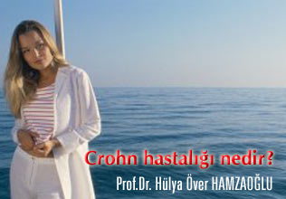 Crohn hastalığı nedir?
