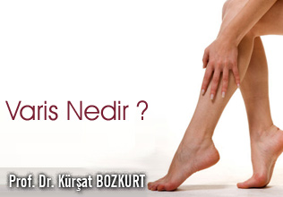 VARİS NEDİR?