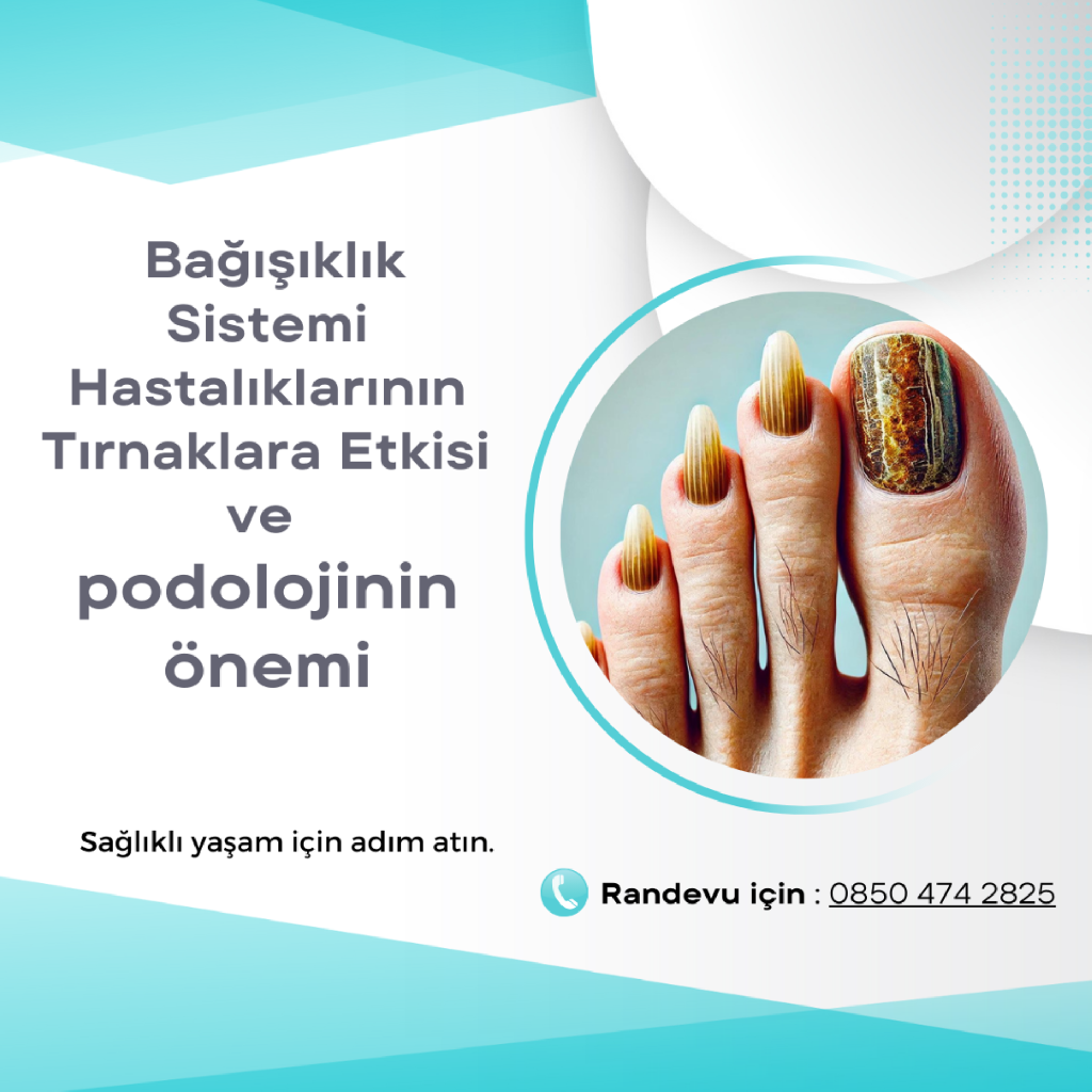 Bağışıklık Sistemi Hastalıklarının Tırnaklarda Oluşturabileceği Sorunlar ve Podolojinin Önemi makalesi