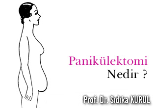 Panikülektomi nedir ? herkes için hafifleme