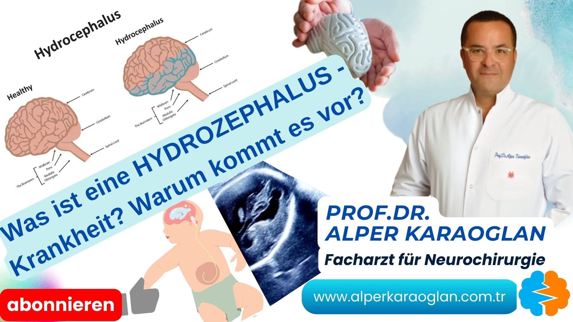 Was ist eine HYDROZEPHALUS-Krankheit? Warum kommt es vor?