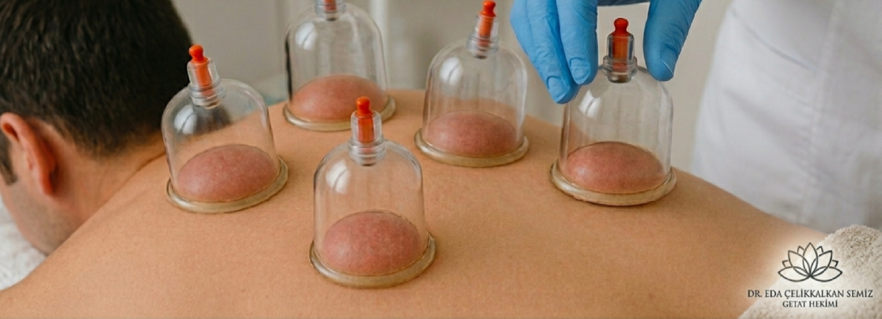 KRONİK YORGUNLUK VE HACAMAT