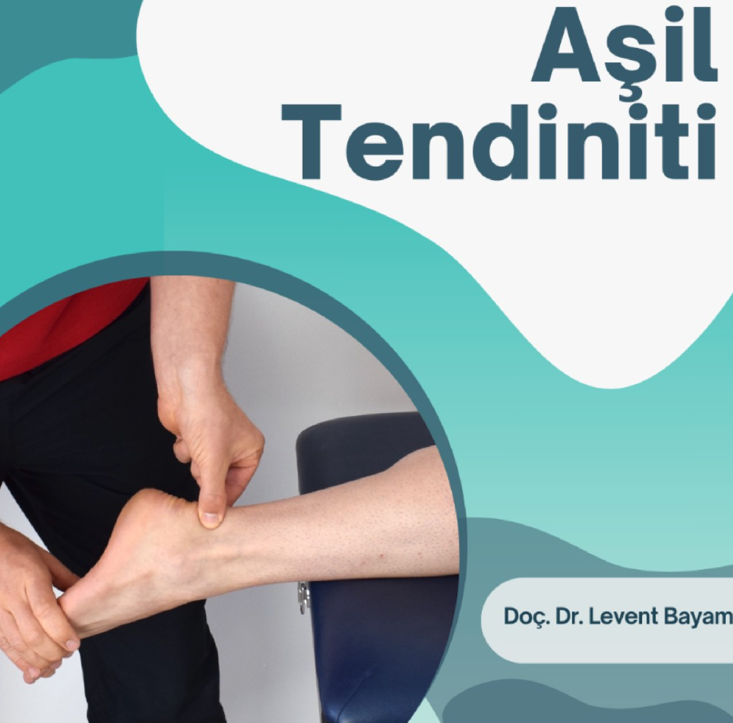 Aşil Tendiniti makalesi