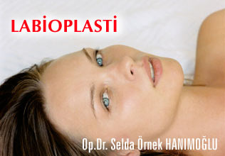 Labioplasti(iç dudakçıkların düzeltilmesi)