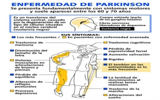PARKİNSON HASTALIĞI TİTREME YURUME BOZUKLUĞU