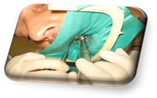 Rubber-dam Nedir ve Neye yarar?