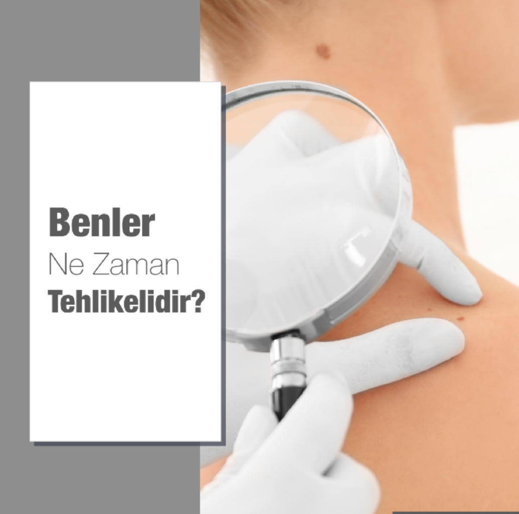 BENLER NE ZAMAN TEHLİKELİDİR?