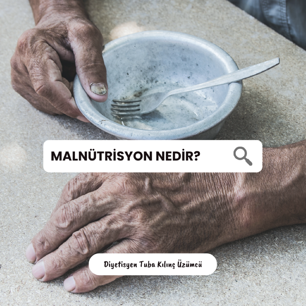 Malnütrisyon/Beslenme Yetersizliği makalesi