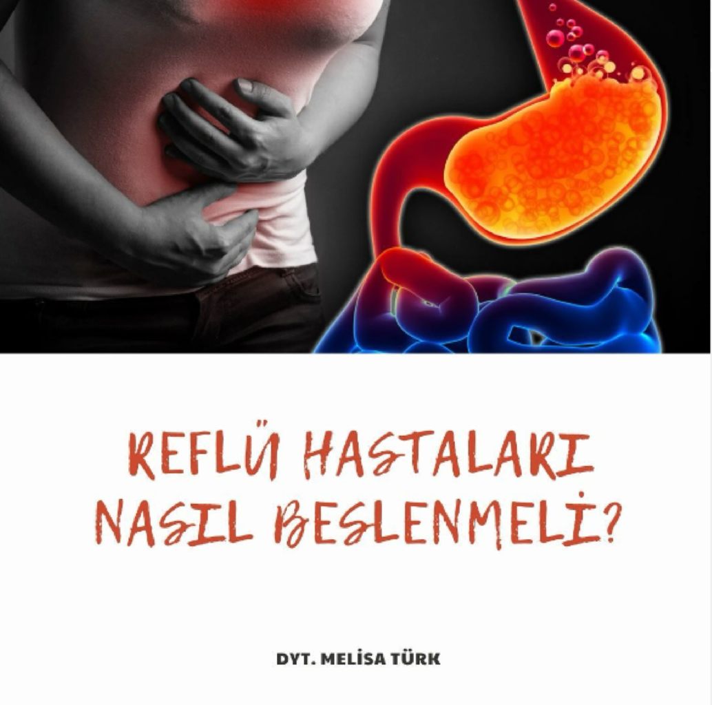 Reflüsü Olanlar Nasıl Beslenmeli?