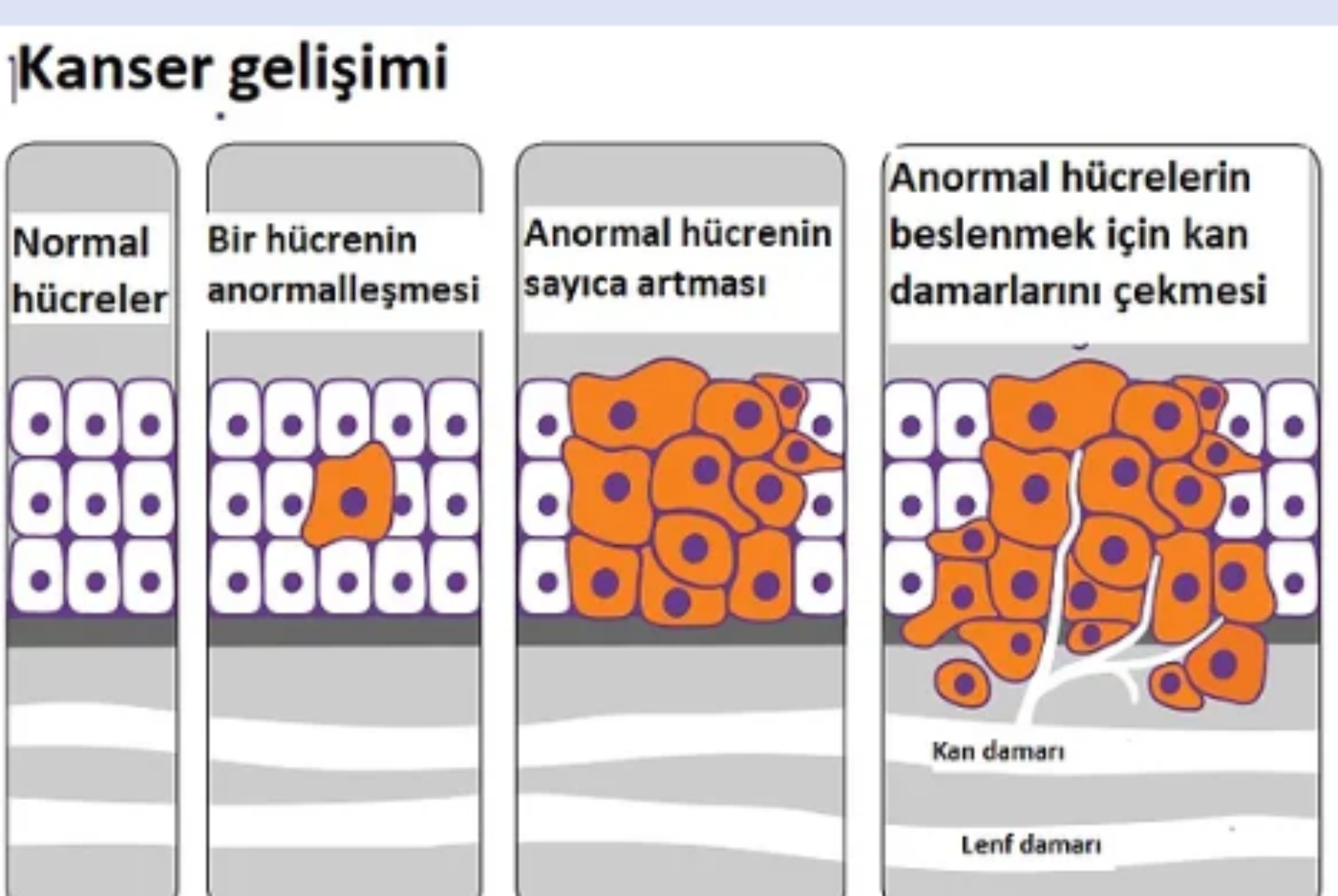 KANSER NEDİR makalesi