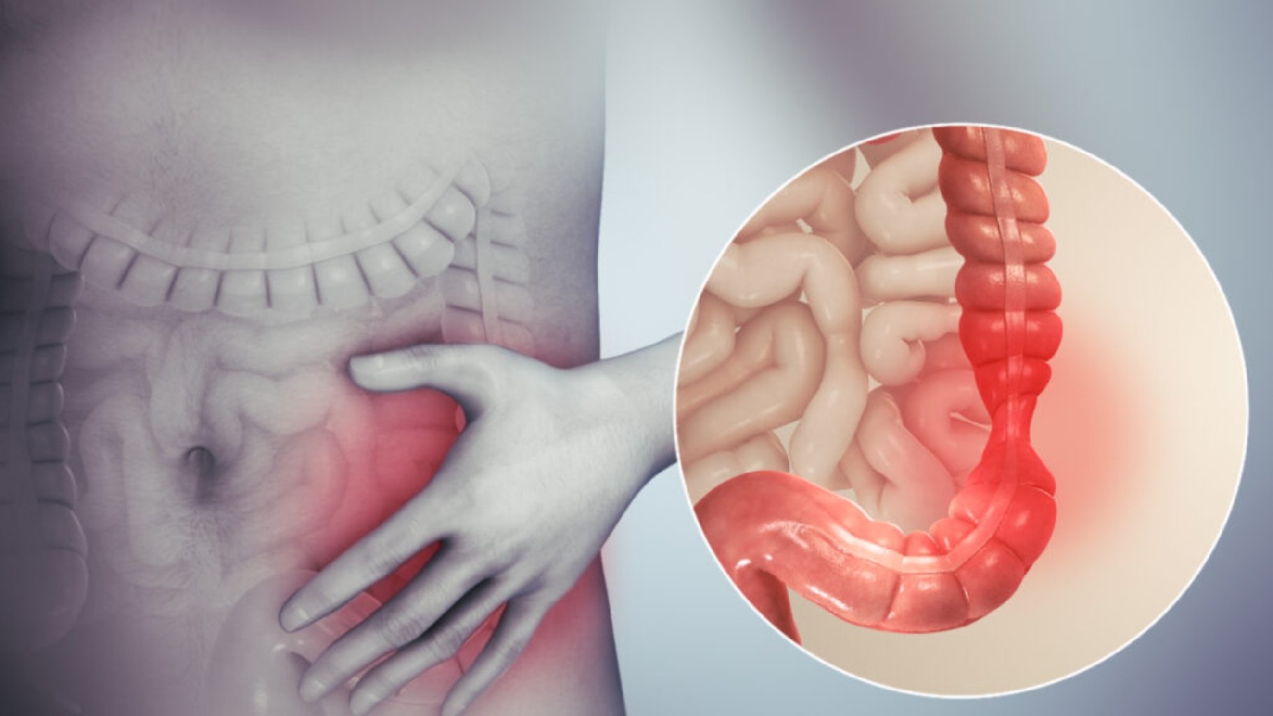 IBS, Düzensiz Bağırsak Sendromu Nedir? makalesi