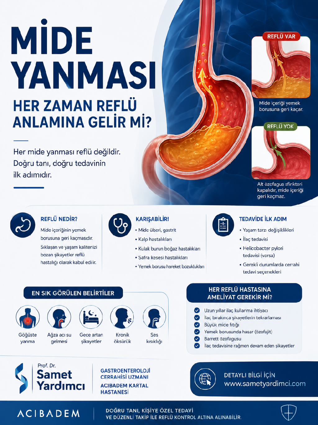 Mide Yanması Her Zaman Reflü Anlamına Gelir mi?
