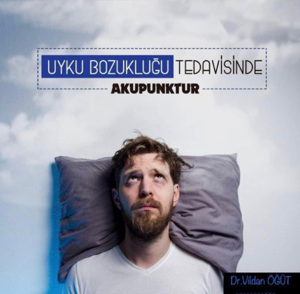 UYKU BOZUKLUGU TEDAVISINDE AKUPUNKTUR: makalesi