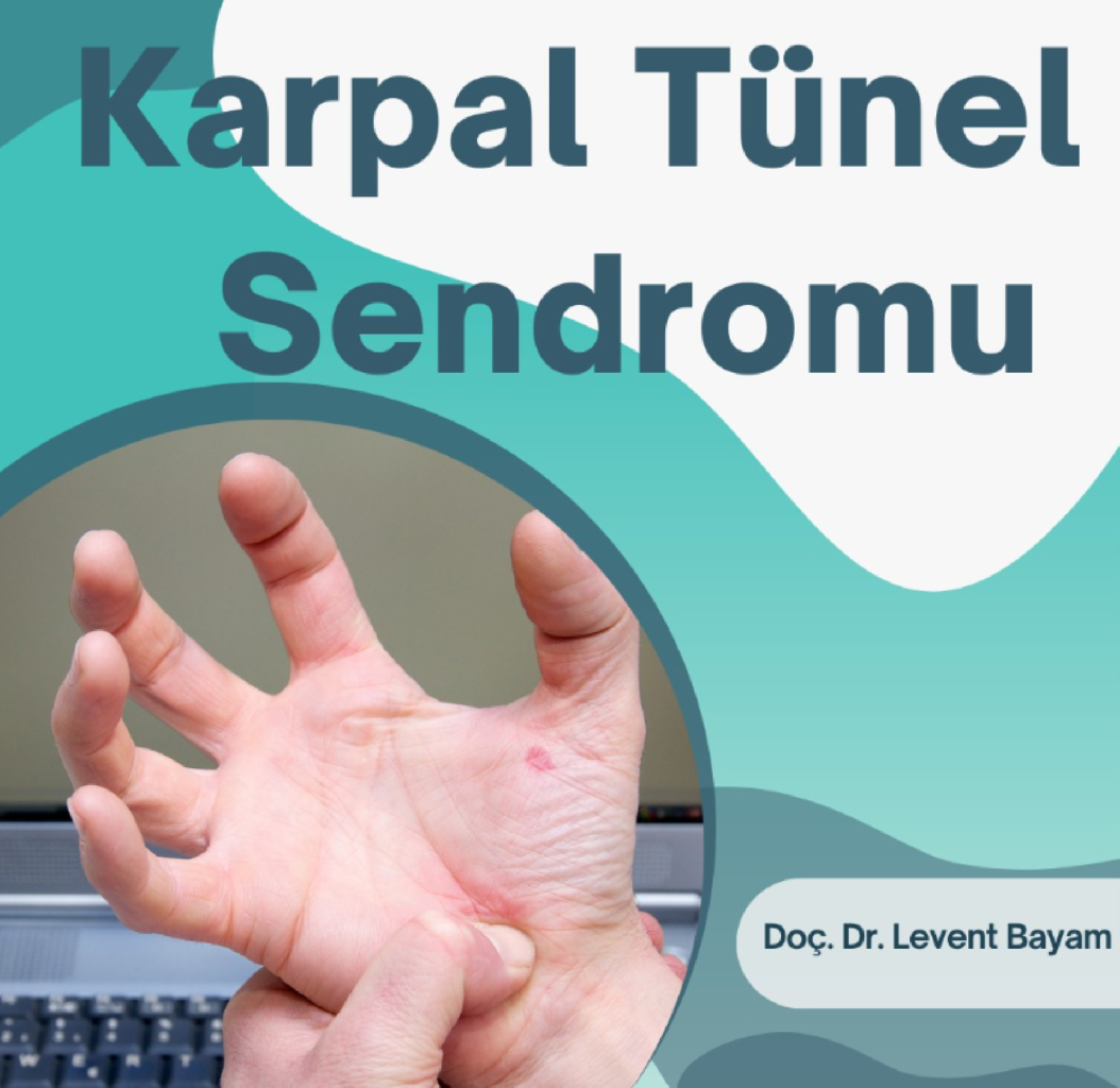 Karpal Tünel Sendromu makalesi