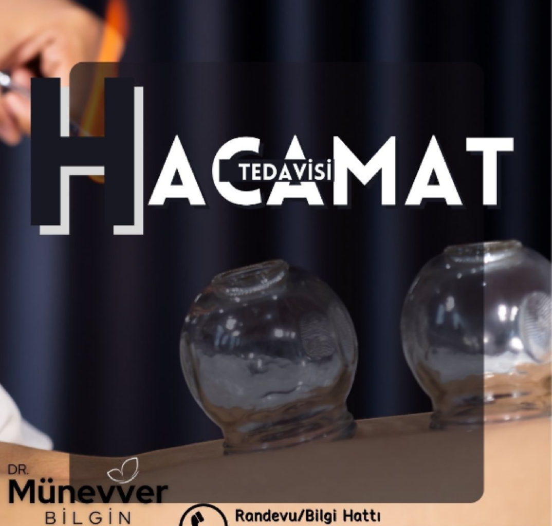 Hacamat makalesi