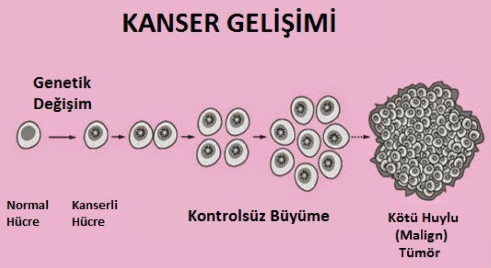 KANSER AMELİYATI CERRAHİSİ NEDİR ?