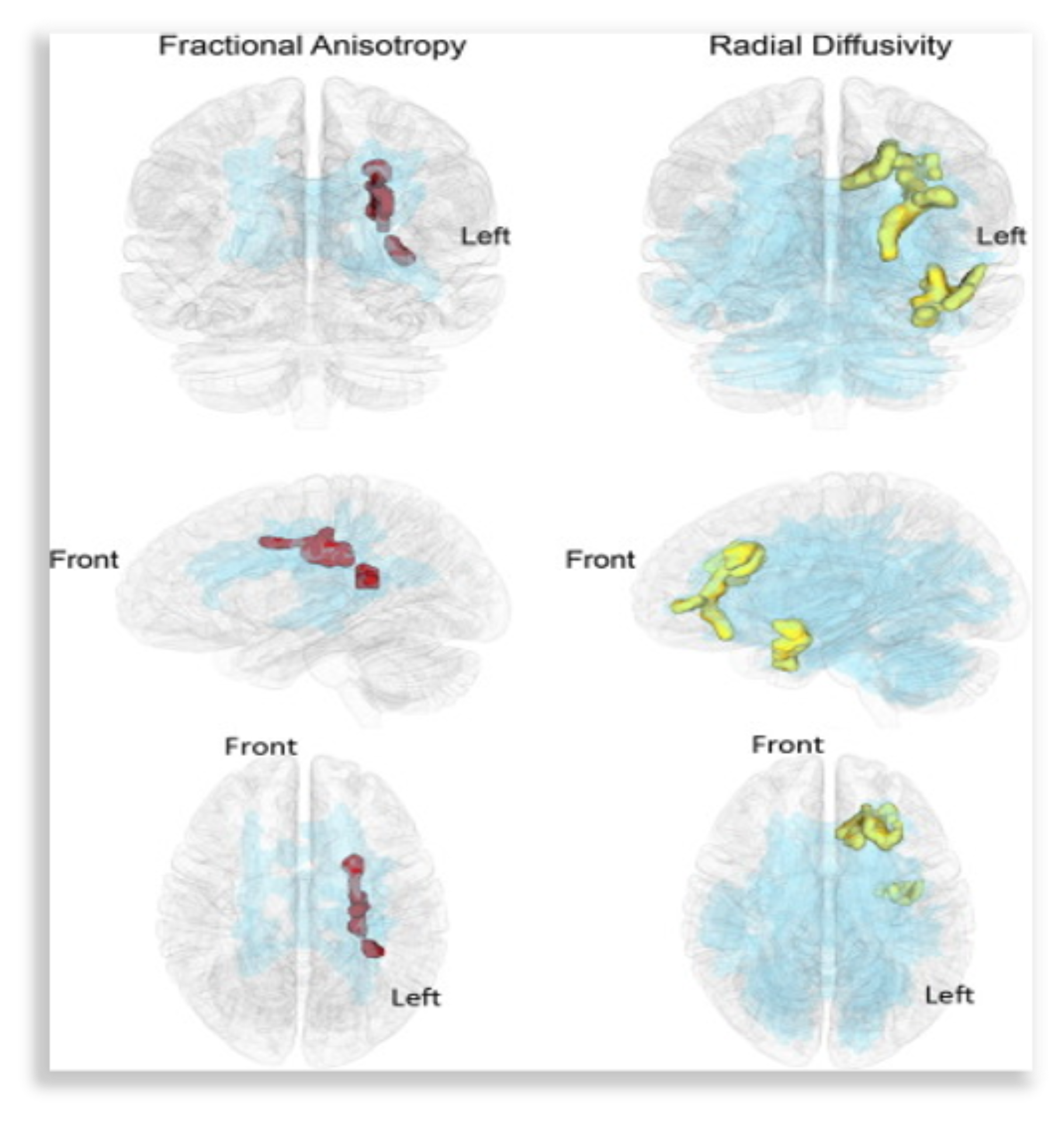 İki Dil İle Büyümek Avantaj mı ? Yoksa Dezavantaj mı ?