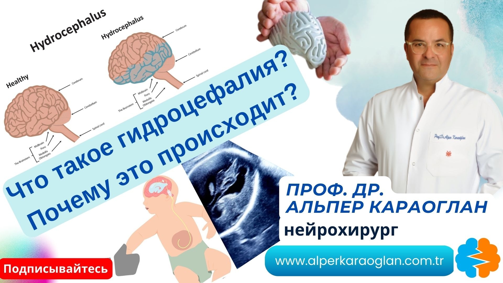 Что такое гидроцефалия? Почему это происходит?