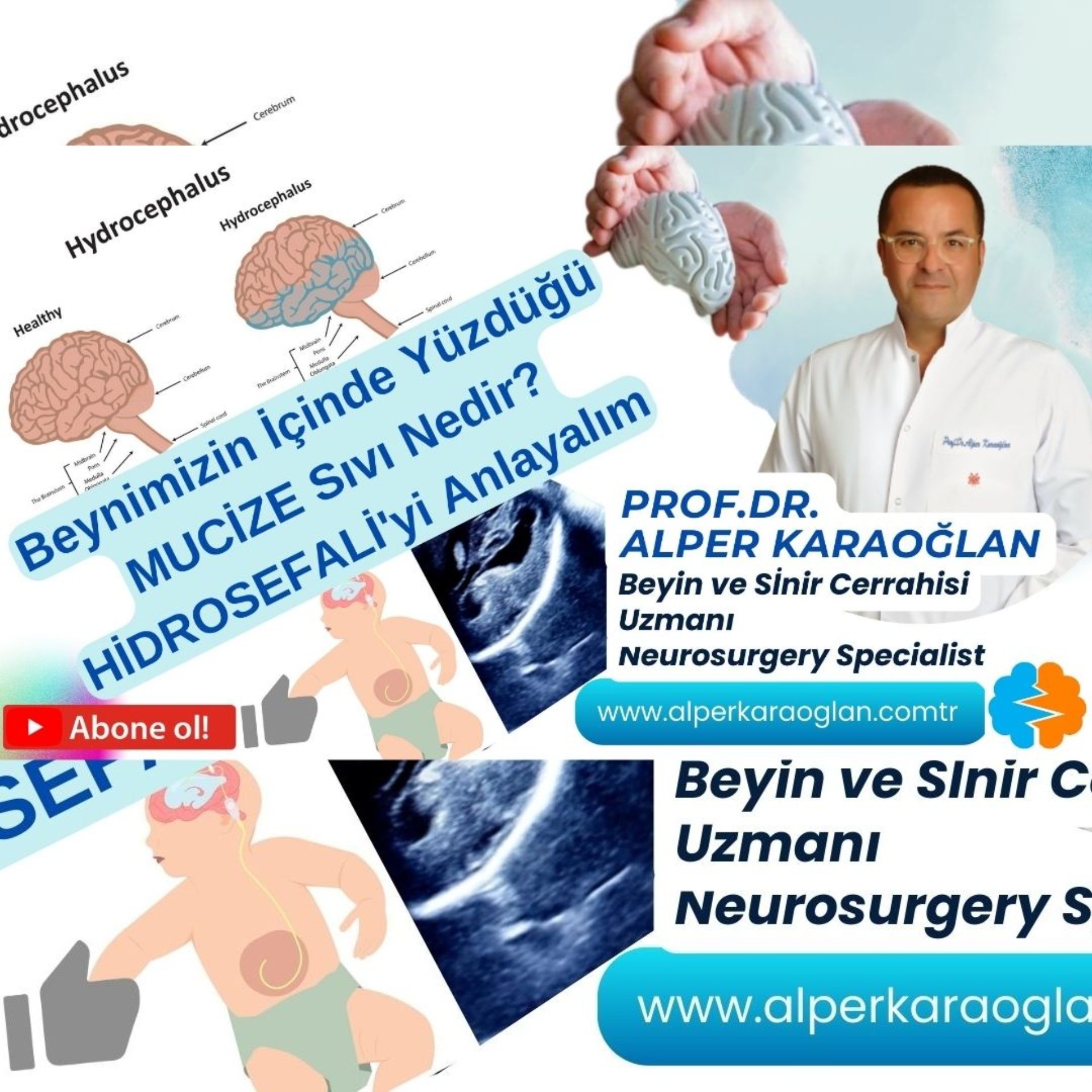 Beynimizin İçinde Yüzdüğü MUCİZE Sıvı Nedir? | HİDROSEFALİ’yi Anlayalım