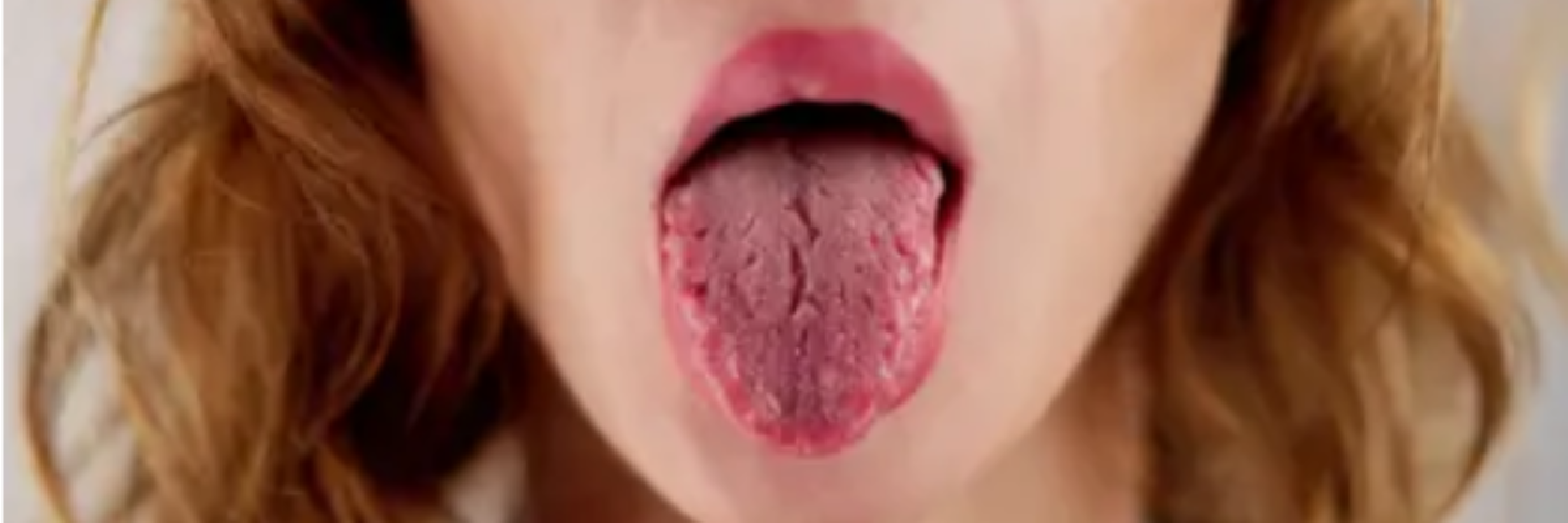 Ağız Kuruluğu Neden Olur?