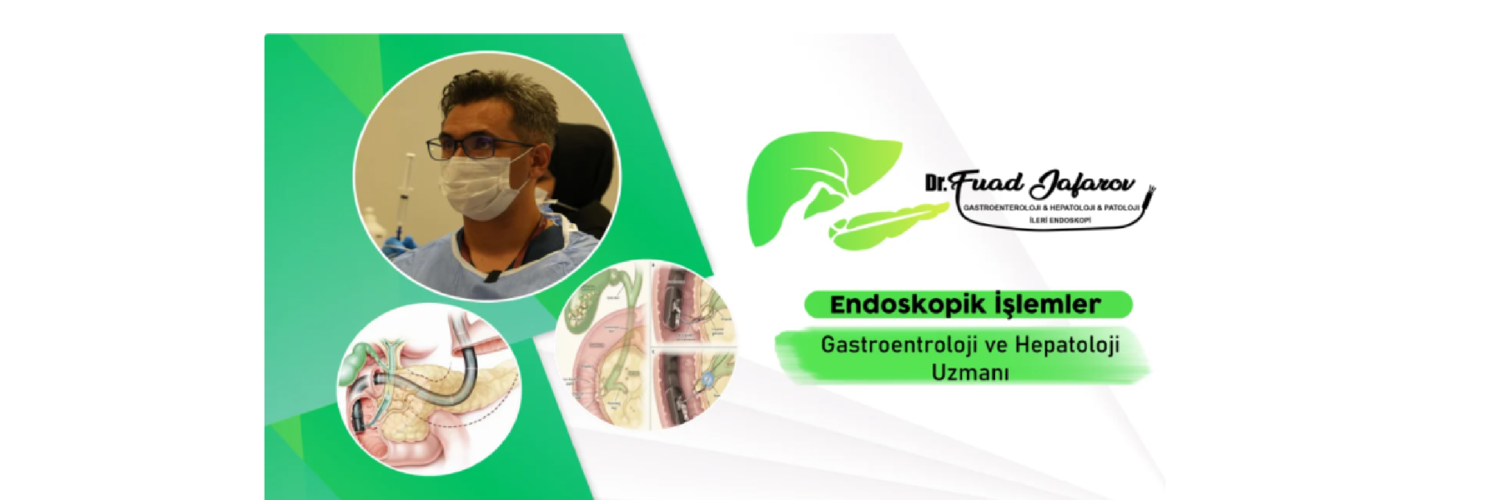 İrritabl Bağırsak Sendromu (IBS) Olanlar Oruç Tutabilir mi? – 1