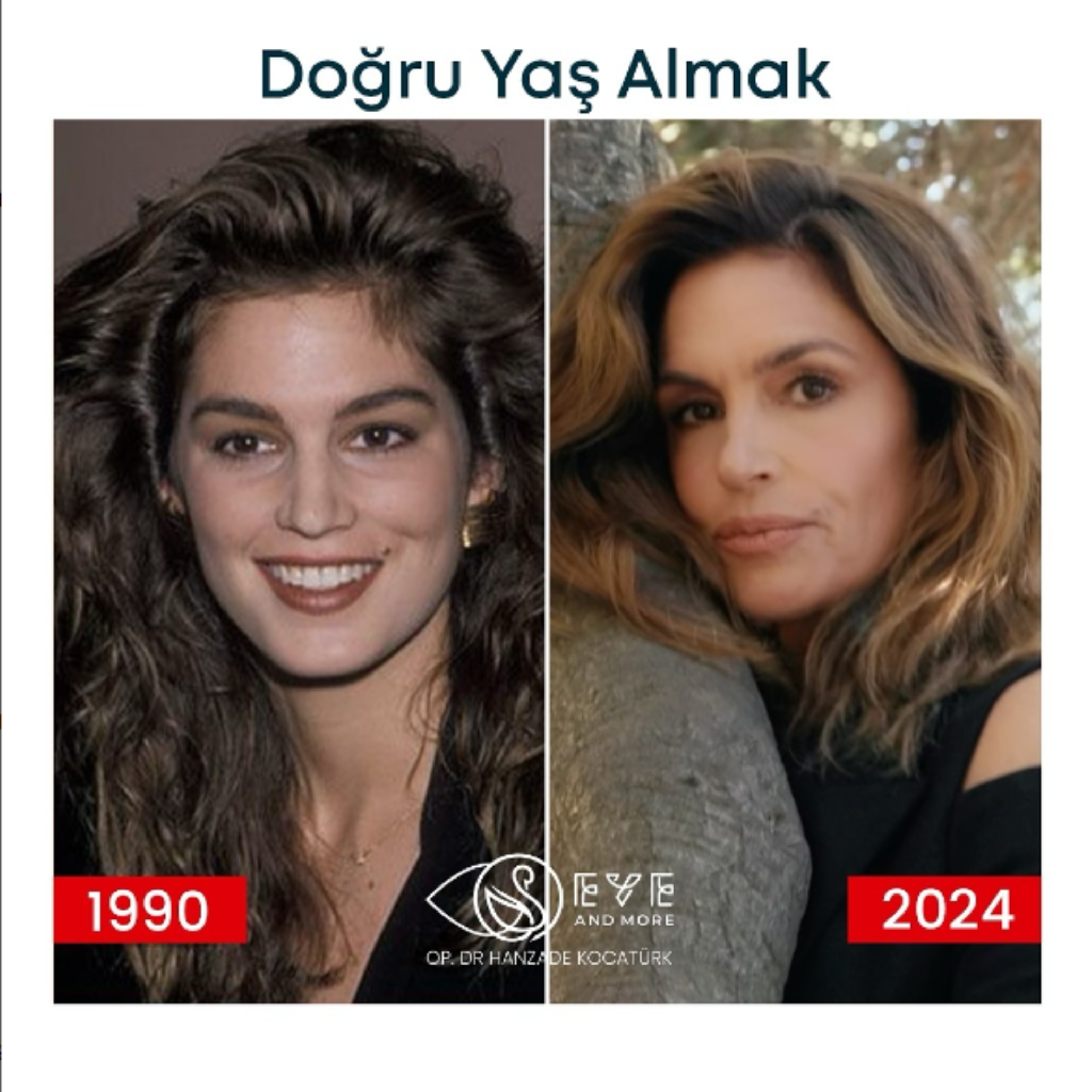 🌟 Doğru Yaş Almak Neden Önemlidir?