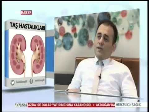 Doç. Dr. Çağrı Güneri Üriner Sistem Taş Hastalıklarını Anlatıyor