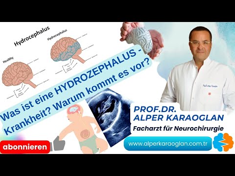 Was ist eine HYDROZEPHALUS-Krankheit? Warum kommt es vor? | Prof.Dr. Alper KARAOGLAN