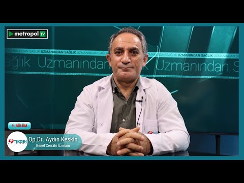 OBEZİTE