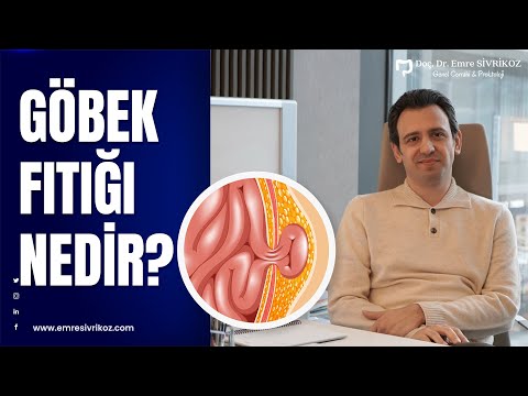 GÖBEK FITIĞI HAKKINDA MERAK EDİLENLER