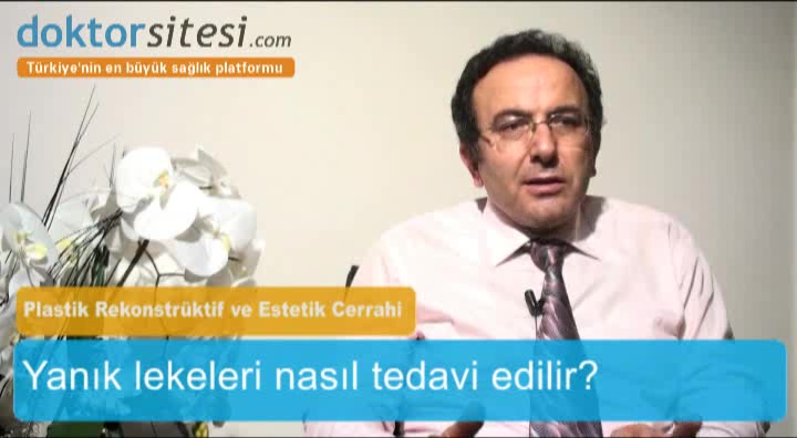 Yanık lekeleri nasıl tedavi edilir?