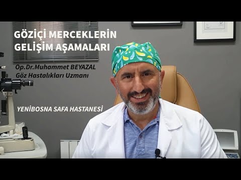 GÖZİÇİ MERCEKLERİN GELİŞİM AŞAMALARI