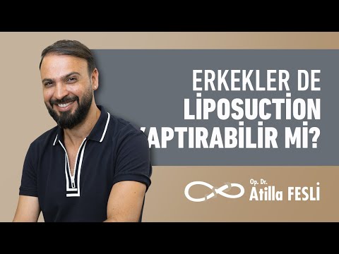 Erkekler De Liposuction Yaptırabilir Mi?