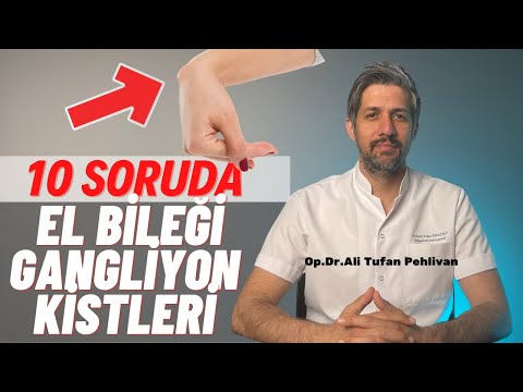 El Bileği Gangliyon Kistleri // El Bileğimde Şişlik Var, El Bileği Kisti, El Bileği Ağrısı