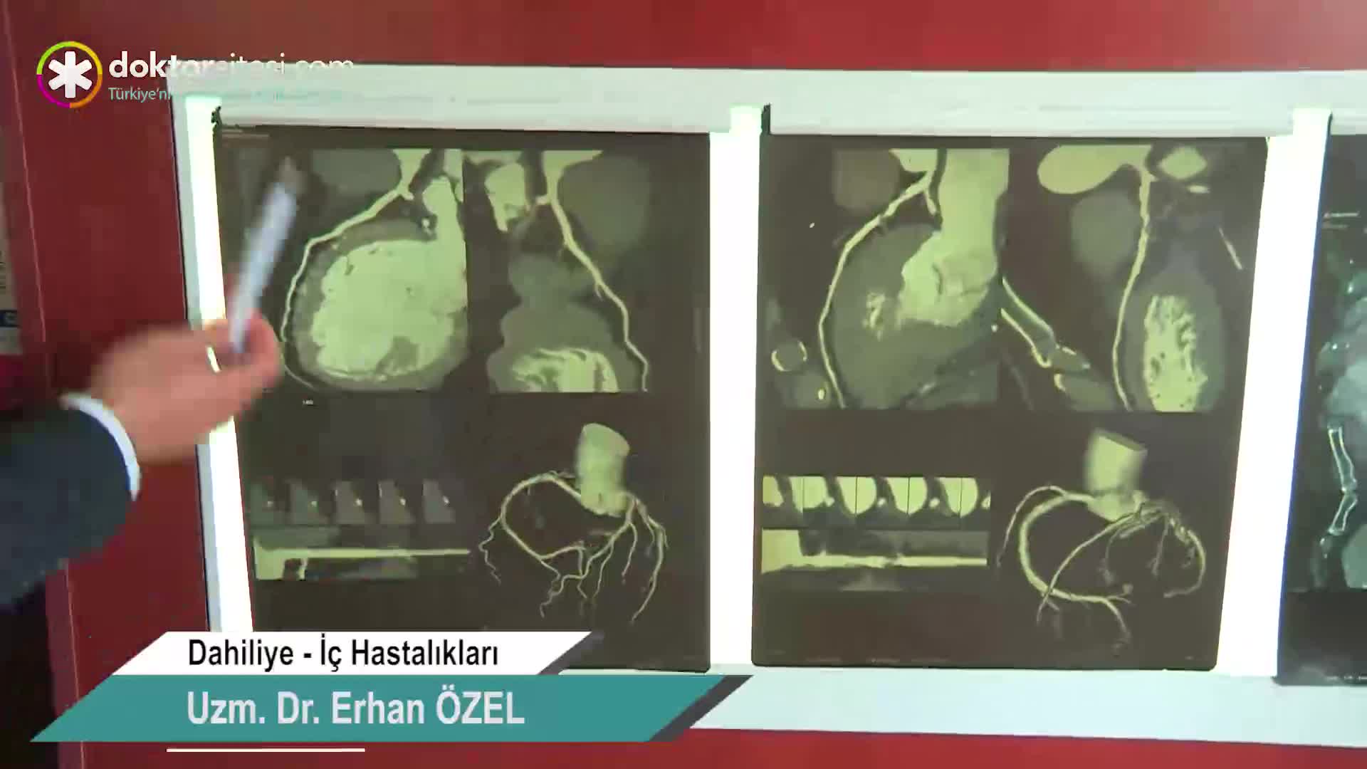 Koroner BT / kalp anjiyosu neden önemlidir?