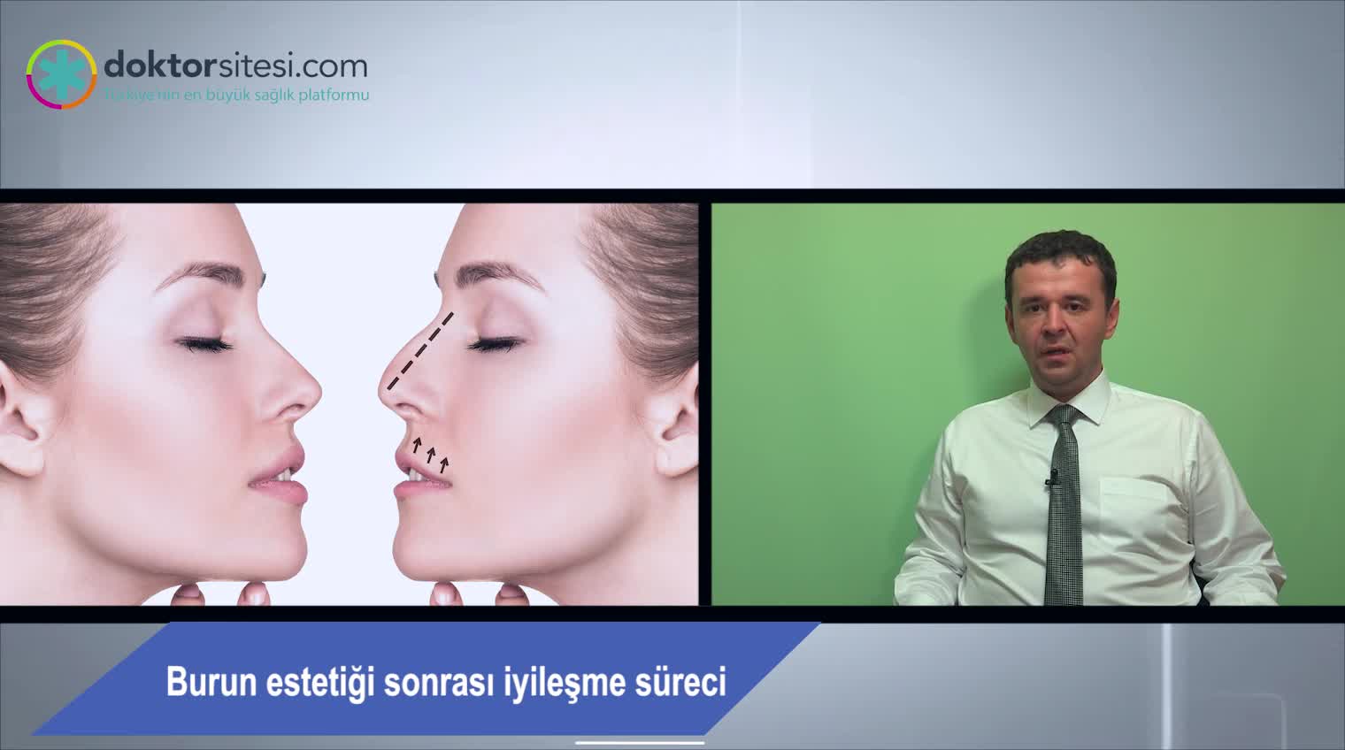 Burun estetiği sonrası iyileşme süreci